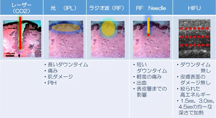 他の治療装置と比較