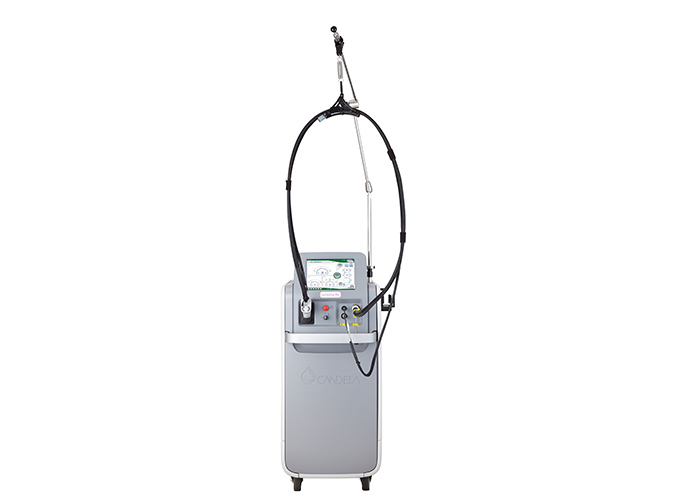 老人性血管腫レーザー治療