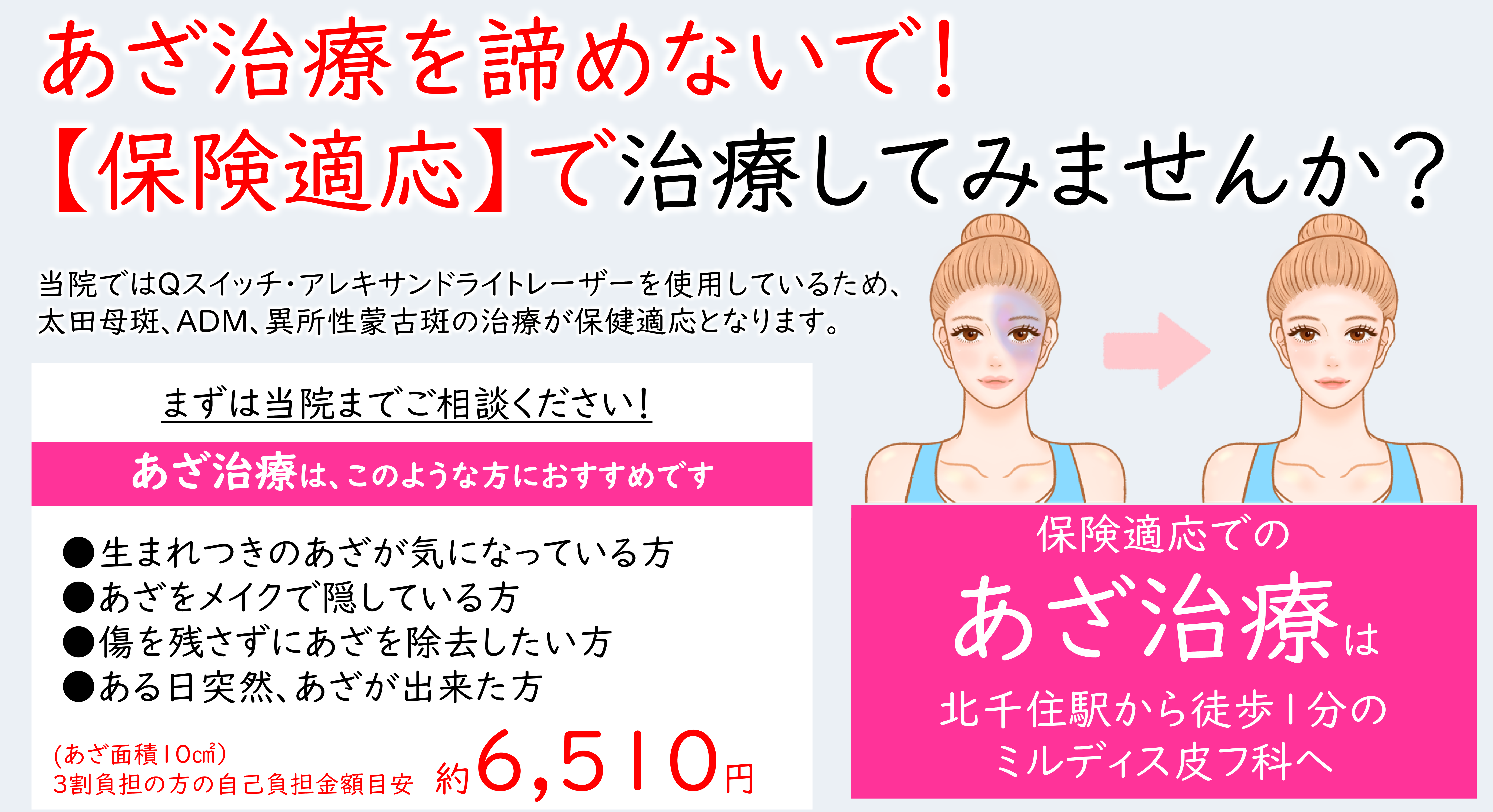 アザ（太田母斑）のレーザー治療について