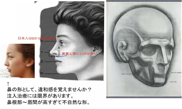 画像に alt 属性が指定されていません。ファイル名: image-55-2.jpg