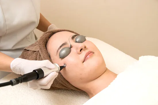 Qスイッチレーザー